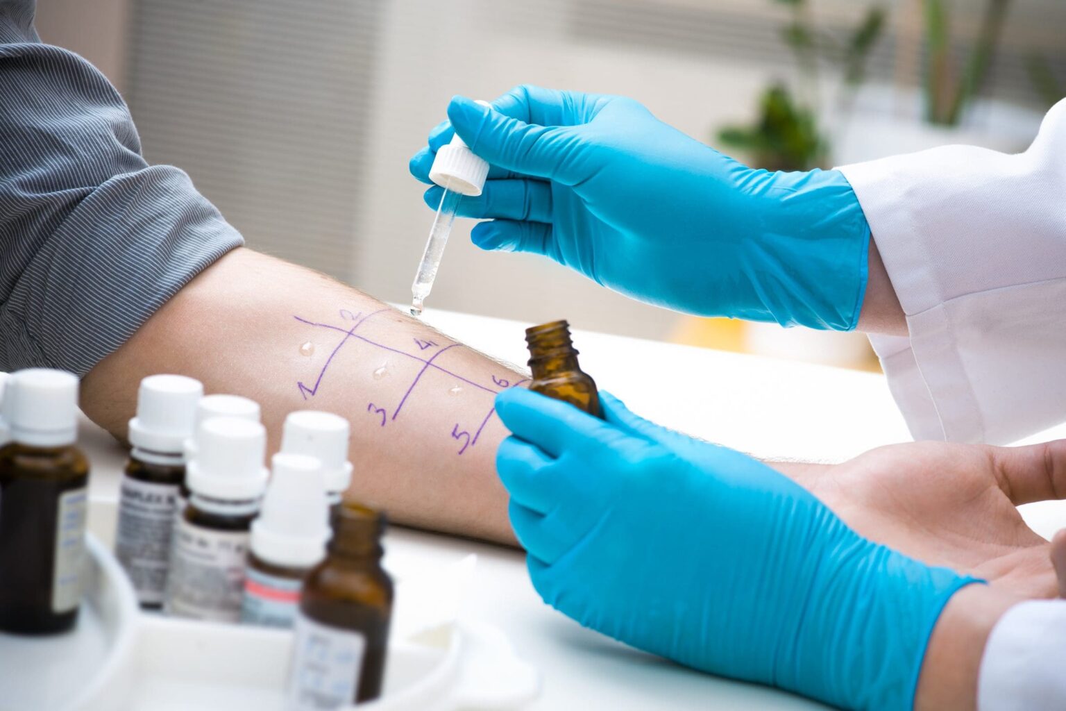 Helpful Things To Know About Allergy Testing