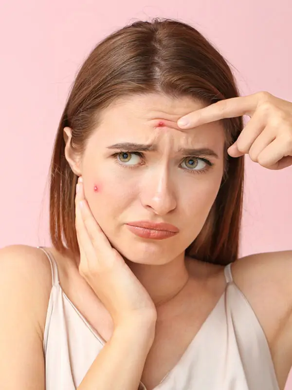 Overcoming Challenges With Spider Veins
